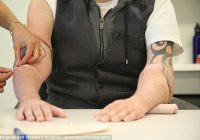 “Не дочекаюся, щоб обійняти наречену”: піхотинець, якому пересадили обидві руки